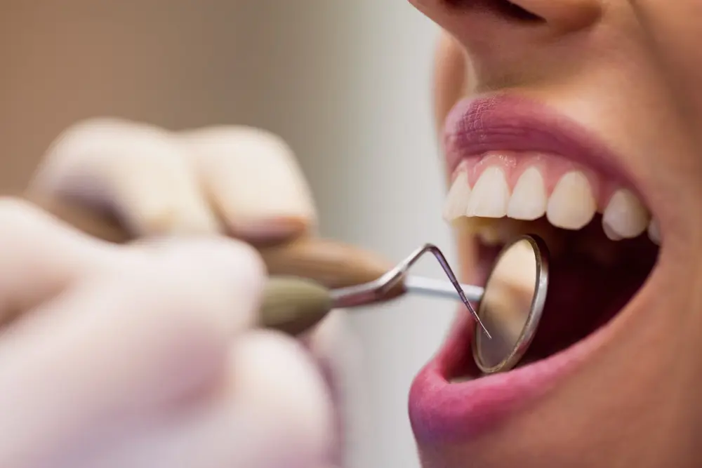 Especialistas en Limpieza dental con ultrasonido en Coyoacán CDMX