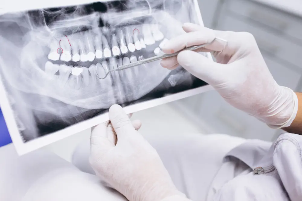 Tecnología avanzada en Radiografía dental en Coyoacán CDMX
